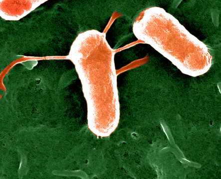 We are recruiting :-)  
The Ben-Yehuda and Rosenshine labs at HUJI, Israel, are recruiting postdocs in the field of Bacteriology and Host-Pathogen Interaction; an ERC-funded project. 
For more information:
ilanrlab.com
sigalbylab.com 
byrsynergy.com