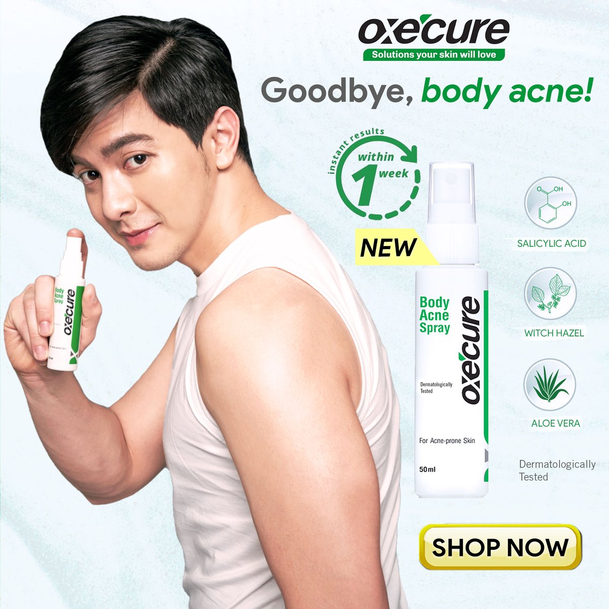 Oxecure_PH's tweet photo. Oxecure's got Alden’s back and Alden’s got yours! @aldenrichards02 recommends only the best solution to fight body acne! Our dermatologically proven Body Acne Spray visibly reduces your body acne in just 1 week! 💚 #OxecureXAldenGotYourBack #OxecurePH #OxecureInControl https://t.co/smMiepcd7z