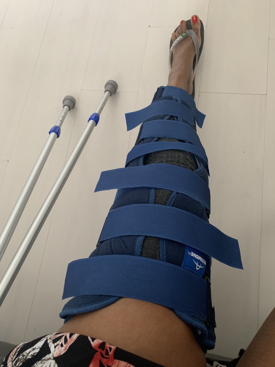 Trupial76's tweet photo. De 1ste mnd kon ik haar niet uitstaan. Elke kans die ik had, deed ik haar af. De 2e mnd ging ik haar steeds meer waarderen. Ze is toch ergens goed voor. #operatie #mpflreconstructie #brace #spalk #revalidatie https://t.co/zHKUEV7QvG