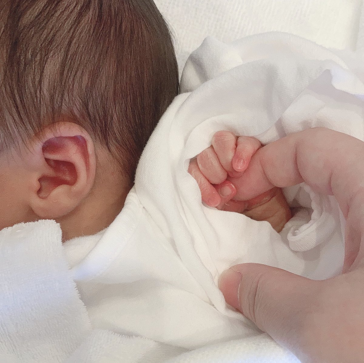 新生児 ちんちん おちんちん 小児外科 小児泌尿生殖器外科 順天堂医院 新生児 ちんちん おちんちん 小児外科 小児泌尿生殖器外科 順天堂医院