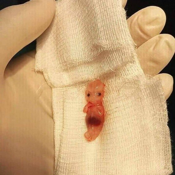 fIawIesshit's tweet photo. vazo o baby groot bala fini https://t.co/qqiusdthOC