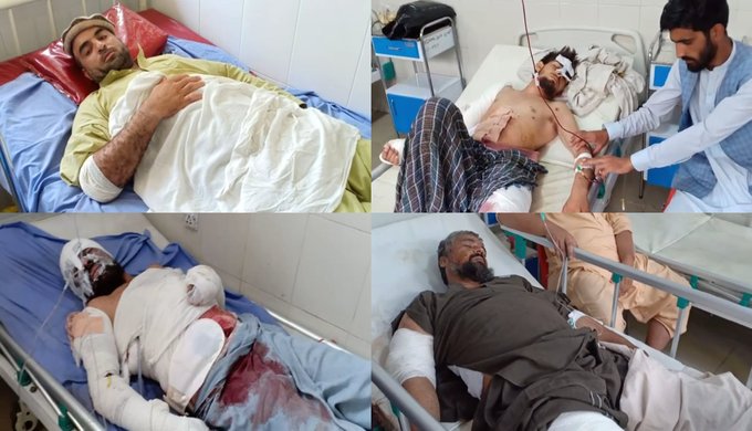 IMAGES of those wounded in the Jalalabad attack.  #Nangarhar  #Afghanistan