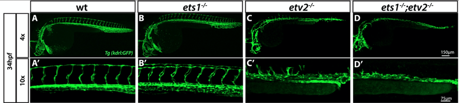 Dev_Bio_Journal's tweet photo. #DBfeatures #DBpreview #DevBio #zebrafish 🐟
"Ets1 functions partially redundantly with Etv2 to promote embryonic vasculogenesis & angiogenesis in zebrafish" by Satish Casie Chetty & Saulius Sumanas, in our new Sept 1, 2020 issue!
Check it out here -> https://t.co/BRAKjjJUKl https://t.co/64KU2lcavX