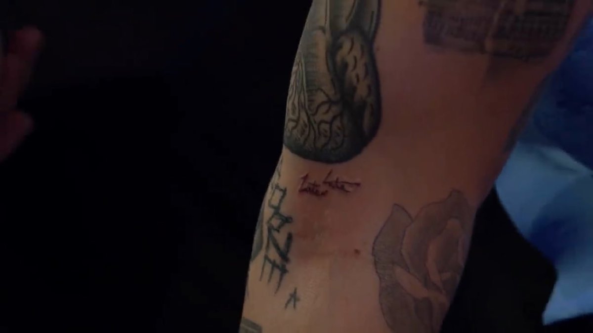 James forced Harry to get a tattoo that he obviously didn't want