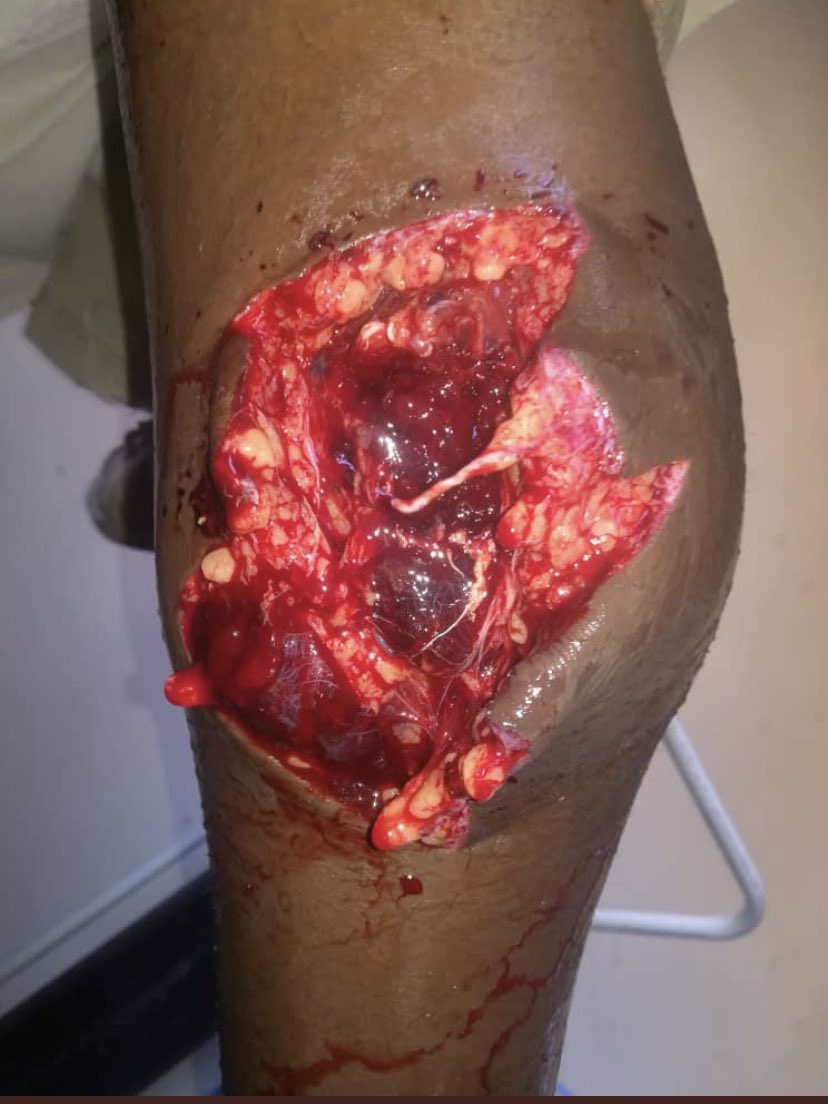 Remember these Western lobbyists <a href="/btpadvisers/">BTP Advisers</a> <a href="/Mercury_NJ/">Mercury New Jersey</a> <a href="/avenustrategies/">Avenue Strategies</a> <a href="/BallardFirm/">Ballard Partners</a> The lobbyists have children &amp; grandchildren. Here’s Tawanda Muchehiwa, tortured by a regime they support. Tell them of the evil they are sugarcoating.