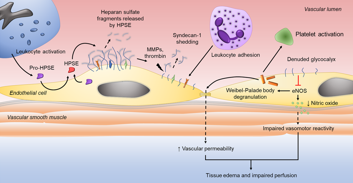 From our upcoming Special Issue on Proteoglycans: Heparanase-enhanced Shedding of Syndecan-1 and Its Role in Driving Disease Pathogenesis and Progression is free online. Click to read: bit.ly/39WnwYu #virus #cancer #extracellularmatrix #proteoglycan #glycosaminoglycan
