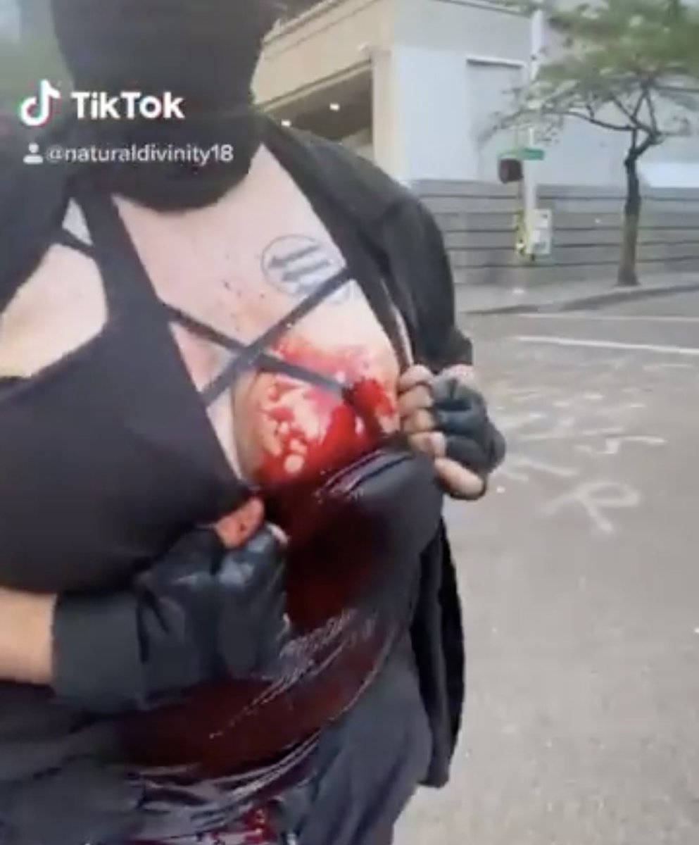 MrAndyNgo's tweet image. The person who was stabbed is a Portland-area antifa militant. She’s being treated in the hospital for the wound to the breast.