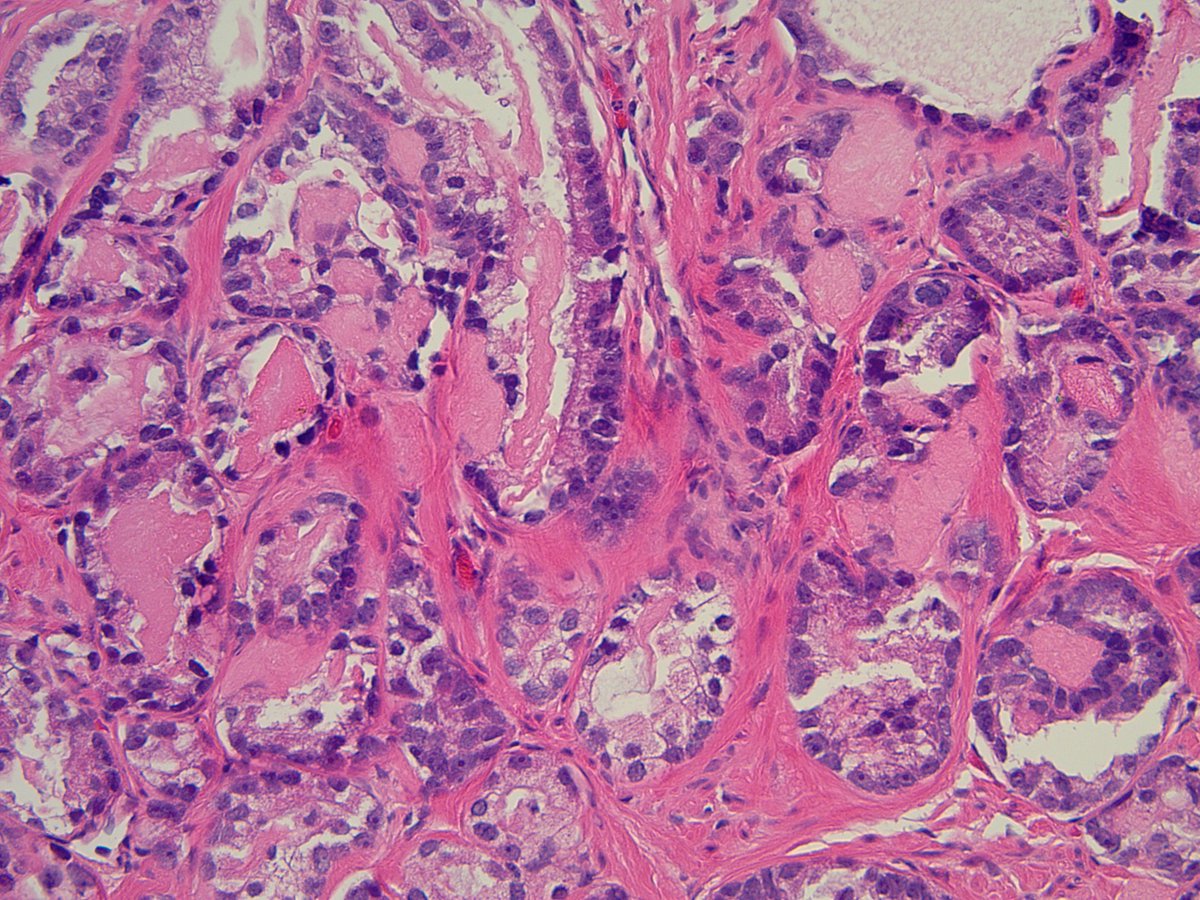 Sean R Williamson MD tweet media