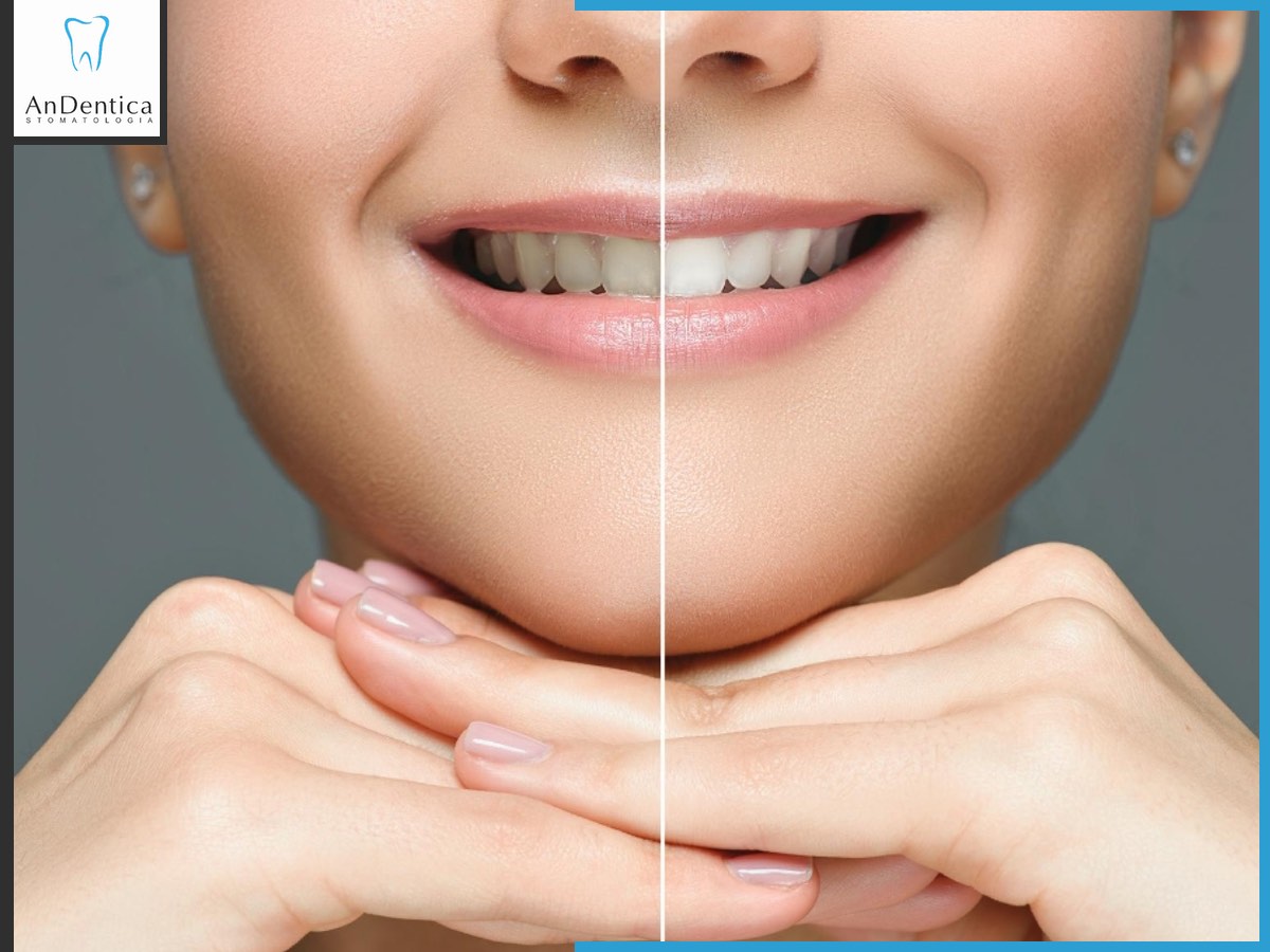 AnDentica tweet media