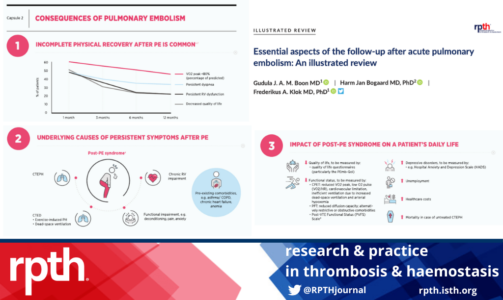 RPTHjournal's tweet photo. Attention patients who have had pulmonary embolism! After acute care, #PE can have lasting impacts on health. In this must-read #RPTHIllustratedReview, @Erik_Klok_MD identifies what to expect in long-term management: https://t.co/VrInqxGDyB @thrombosisday https://t.co/JQGfBT2oVX