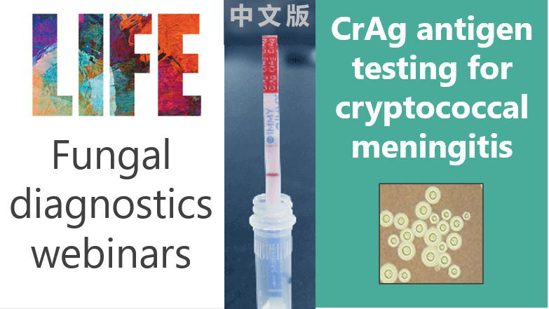 LIFEworldwide's tweet photo. We've just emailed out login details to join tomorrow's CrAg testing webinar - hope to see you all there!
* 13:00-14:15 BST (London time) - Weds 5 Aug
* Join via: https://t.co/0GrIaPxS5M
#hiv #worldhealth #medtwitter #neurotwitter #worldhealth #poct #neuroid #webms #cpd #MedEd https://t.co/26OEqHAmie