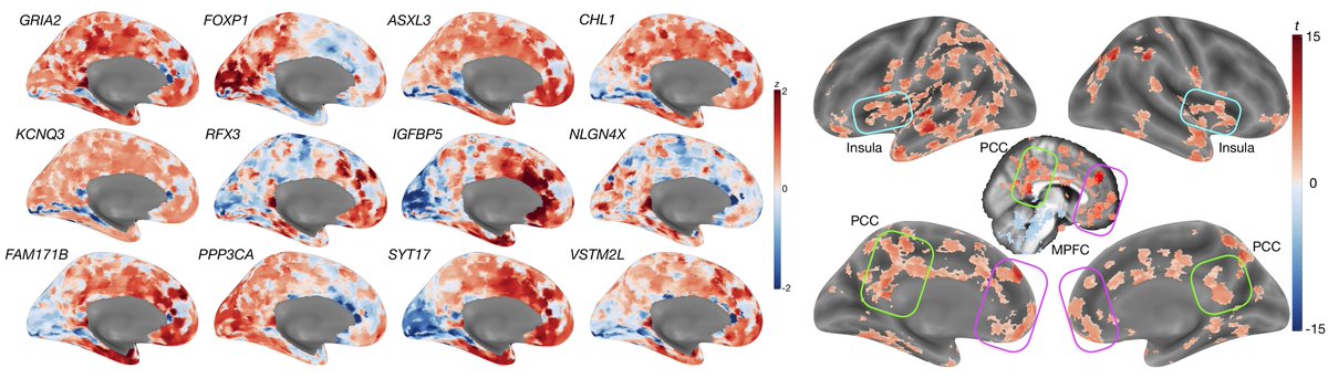 Medial prefrontal cortex and several other brain regions highly express these autism-relevant excitatory genes that are also affected by DHT.