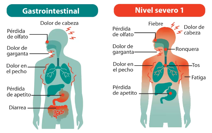 FacMedicinaUC's tweet photo. Gripal sin fiebre, gripal con fiebre, gastrointestinal, y niveles severos 1, 2 y 3. Esos son los 6 cuadros de síntomas con los que ataca el #COVID19. Al respecto habló el Dr. Jaime Labarca junto a @lun 👉 https://t.co/pqzRyaCI7B https://t.co/P2GBeUm6Z8