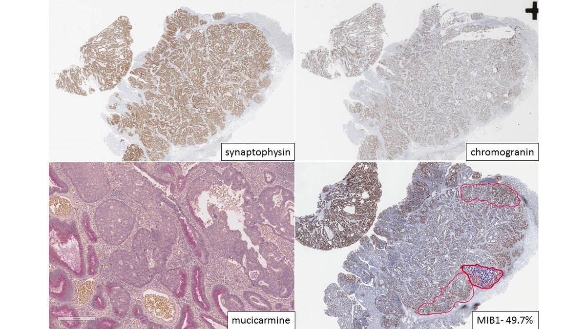 Sangeetha N Kalimuthu tweet media