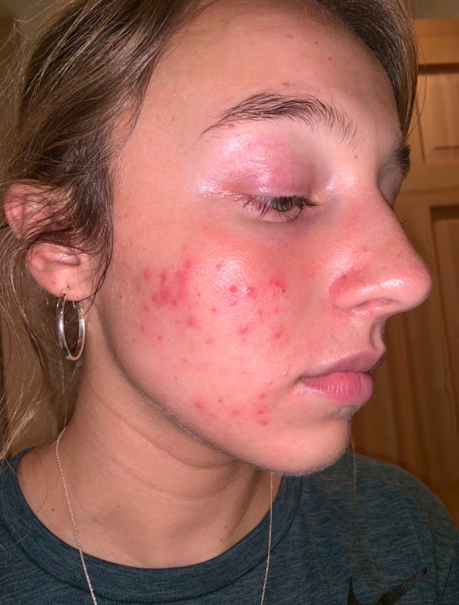 𝓉. 🪽 tweet media