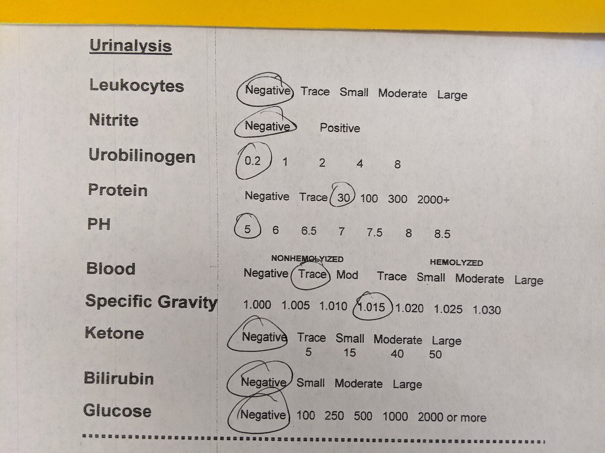 PUZZLE:A patient came in with urinary frequency & urgency.Here is the urinalysis.What do you suspect as the underlying cause? (I will show the answer after a dozen or so replies.)