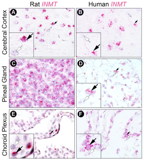 First, they look at where AADC and INMT are expressed in rat and human brains. These are enzymes. Both are needed to synthesize DMT, so looking for where these enzymes are is a first step to identify where you might look for actual  #DMT present in the brain. 6/