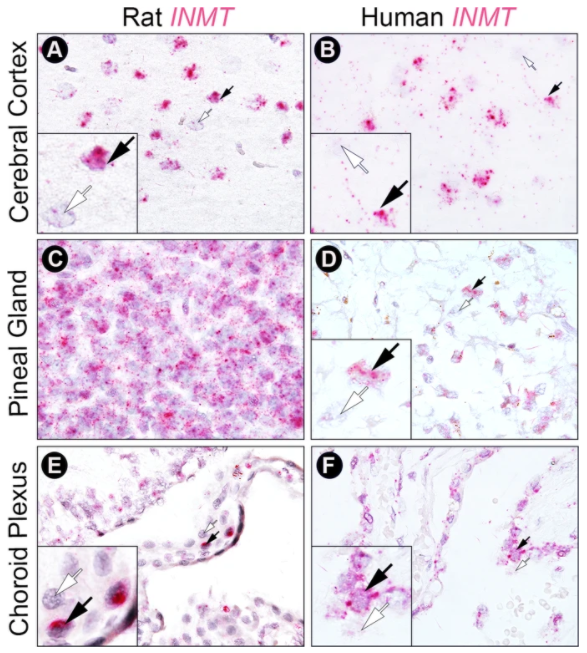They look for INMT in rat and human brain tissues in three places: visual cortex, pineal gland, and choroid plexus (cells produce cerebrospinal fluid). Pinkish blobs in figure are cells w/ INMT. Some cells have it. Notice differences between brain regions and rat vs. human7/