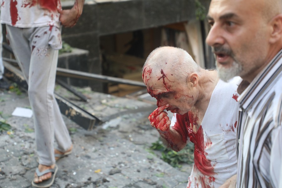 XHNews's tweet photo. Latest on #BeirutBlast:
- Over 73 killed, 3,000 injured; casualties may rise as hundreds are still missing
- Explosives stored at Port of Beirut, reportedly 2,700 tons of ammonium nitrate, may be the cause
- PM vows to punish those responsible
- National mourning day declared https://t.co/iojMwDe2QY