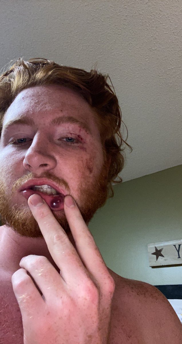 BandyGage's tweet photo. Just a little aftermath https://t.co/lBX2NZftSq