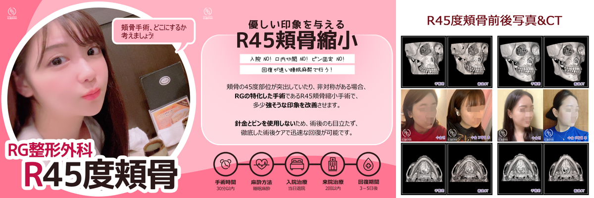 RGplastic's tweet photo. 自然に滑らかに❣️
突き出た45度頬骨を削ってくれるR45度頬骨縮小術❣️❣️

👑RGだけの特化した手術方法👑
🌸R45度頬骨縮小術🌸
で優しい印象に改善できます💗

ピンの固定が無くてDTが短い安全な手術✨

お問合せは
LINE ID➡️RG_PS

＃R45頬骨　＃頬骨体　＃頬骨縮小　#渡韓整形　#輪郭有名な病院 https://t.co/UIZWryqVqF