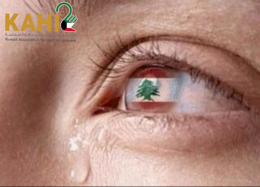 تدمع العين على ما حدث في بيروت و نتمنى السلامة لكل الشعب اللبناني 💔🇱🇧

@kahikuw

#الصم #للصم #لغة_الإشارة #الكويت #إعلان #معاقين #المعاقين #سمع #سمعية #كورونا #خلك_بالبيت #لبنان #بيروت

#kuwait #q8 #deaf #deafculture #signlanguage #asl #disability #corona #lebanon #beirut