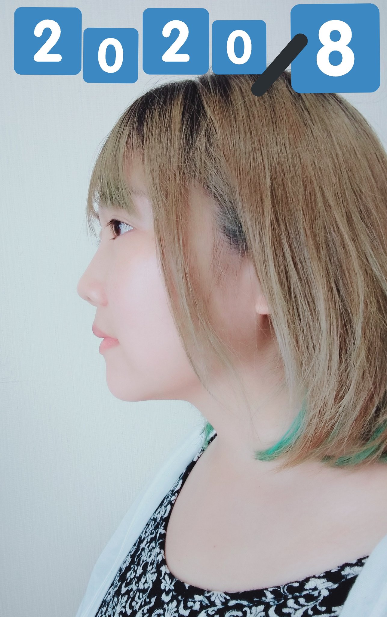 モナ子 Monako 歯列矯正横顔ビフォーアフター 横顔の変遷はこんな感じです 念願のｅラインができました やったあーー T Co Wmwmnxvvn0 Twitter