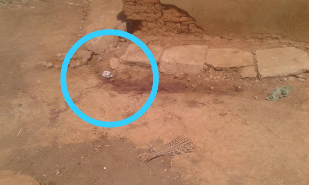 TwahirwaIpha's tweet photo. Mu murenge wa #Rwimiyaga mu karere ka Nyagatare, igisasu cyaturikanye umwana w'umuhungu wo mu kigero k'imyaka 7 kiramukomeretsa bikomeye.ikigo nderabuzima cya #Bugaragara cyamwohereje kubitaro bya @NyagatareDistr.Iki gisasu birakekwa ko cyari kimaze igihe mu butaka @flashfmrw https://t.co/OlAfj0QX5c