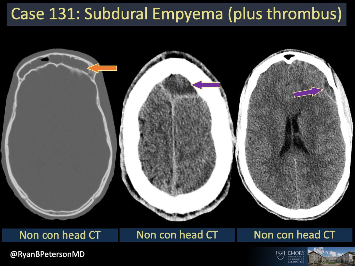 emory-radiology-cotd-131-hx-altered-headaches-no-spoilers-or-i-will