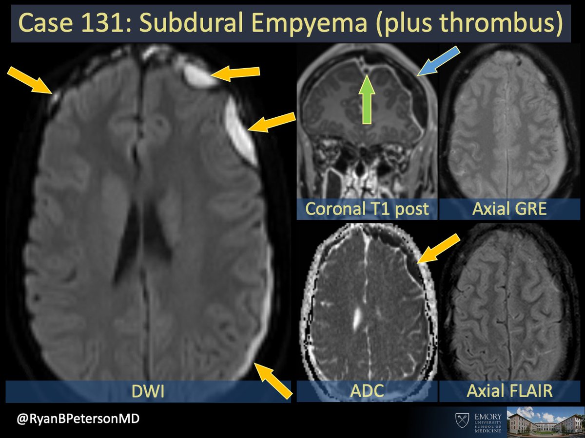 emory-radiology-cotd-131-hx-altered-headaches-no-spoilers-or-i-will