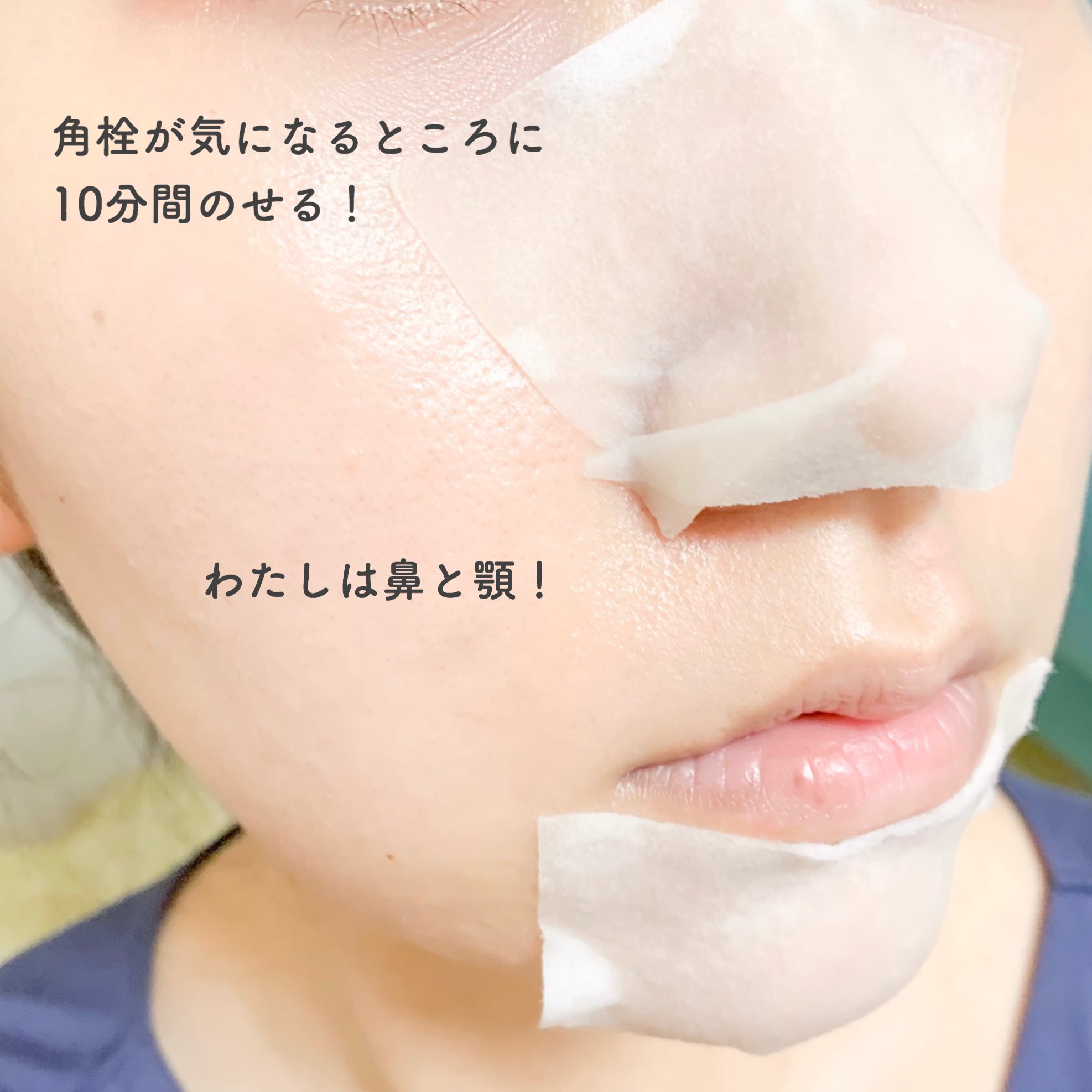 ゆき 再びお休み バイエコム様から角栓クリーナーを頂きました 角栓 クリーナーを染み込ませたコットンを気になる部分に10分間のせて ウォーターピーリング機を当てるだけ 鼻も顎もザラついてたのがツルツル 低刺激で 角栓取れるのが良い 次はおでこ