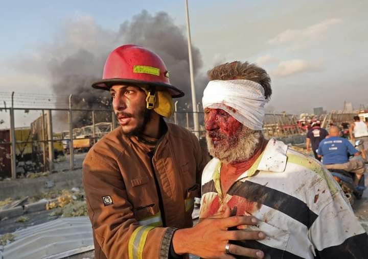 ChoudhuryRi's tweet photo. It's really hurts seeing what's happening in BEIRUT.
May Ållah have mercy upon those people who lost their lives in the explosion, and I wish quick recovery for the wounded.
I share the pain of friendly people of #LEBANON.
#PrayForBeriut #PrayForLabanon 😥 https://t.co/UEP8MY9VuJ