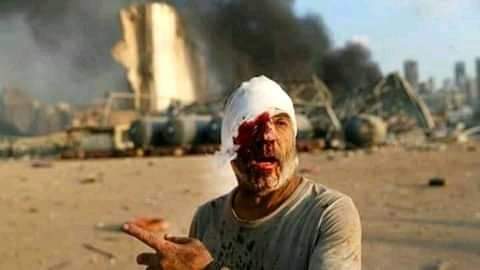 pritam_nawalkar's tweet photo. Our prayers Are with Lebanon 💔😢
#LebanonExplosion #PrayForLabanon https://t.co/L47dVx5VXA