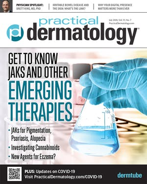 Practical_Derm's tweet image. Vitiligo: Oral and Topical JAKs Show Promise. @SeemalRDesaiMD discusses early studies  that offer some hope for emerging therapies for #repigmentation. Read the full article: hubs.ly/H0tcWXM0 #dermatology #vitiligo #skinofcolor #JAKs