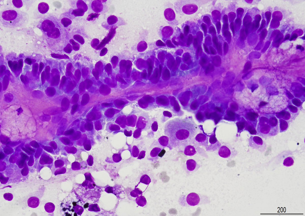 A Matloob, MD tweet media