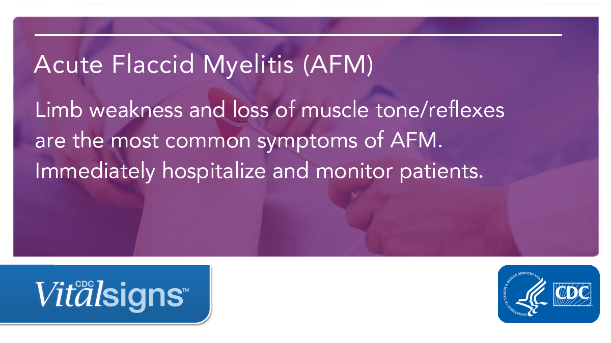 CDCDirector's tweet photo. Sudden limb weakness is the most common symptom of #AcuteFlaccidMyelitis (AFM). AFM can cause paralysis or respiratory failure. It’s a medical emergency - hospitalize patients immediately. Read #VitalSigns to learn the signs of AFM: https://t.co/ItUty6K5vK  #knowAFM https://t.co/wf2kFmYDqW