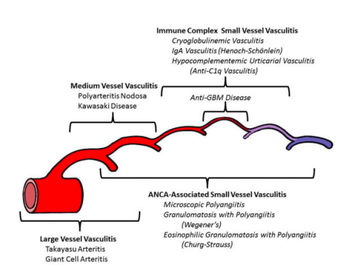 The rename was part of the 2012 Chapel Hill revised nomenclature for vasculitides:  https://onlinelibrary.wiley.com/doi/pdf/10.1002/art.37715. EGPA is an ANCA-associated small vessel vasculitis 6/n