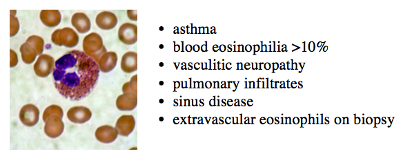 Anyway, back to EGPA. The 1990  @ACRheum diagnostic criteria remain clinically useful. They are under review as we learn more:  https://www.sciencedirect.com/science/article/pii/S0953620515001442  #RespEd  #vasculitis  #eosinophlia 8/n