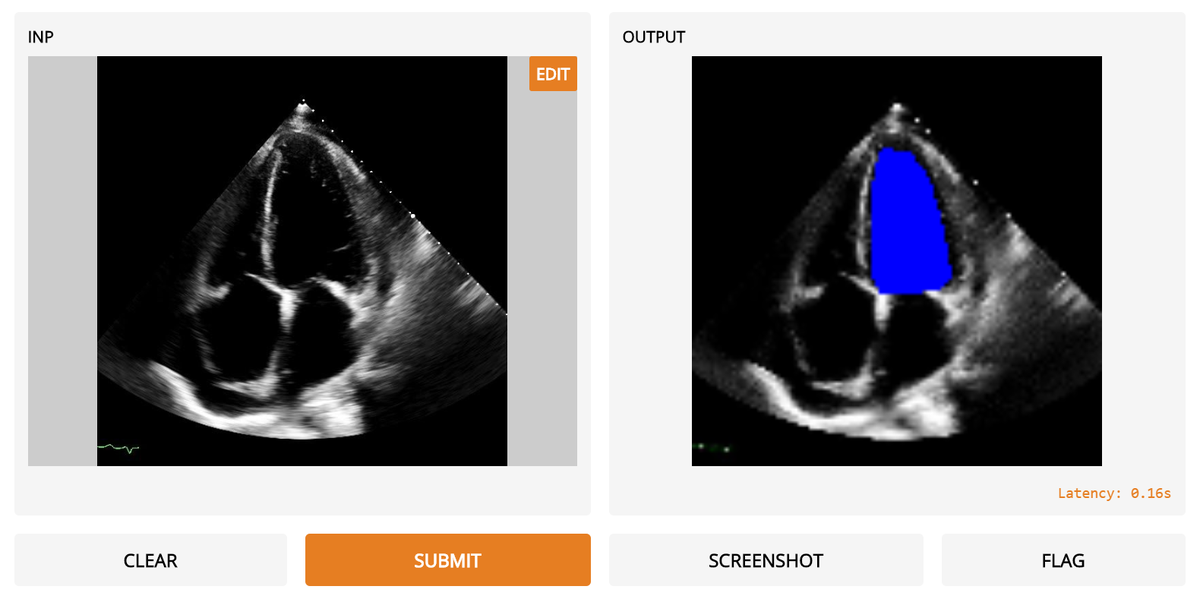 David Ouyang, MD tweet media