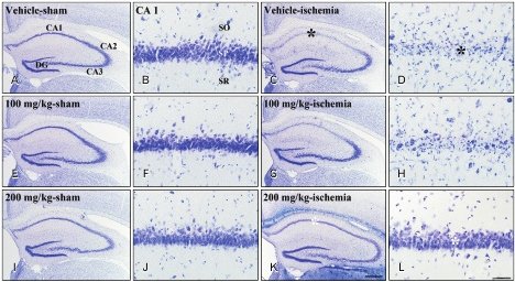 AcbjournalO's tweet photo. Pre-treated Populus tomentiglandulosa extract inhibits neuronal loss and alleviates gliosis in the gerbil hippocampal CA1 area induced by transient global cerebral ischemia
https://t.co/kaOrgBonBb
#대한해부학회 #AnatomyCellBiology
#NeuronalDeath #TransientGlobalCerebralischemia https://t.co/q8E1PAeh2O
