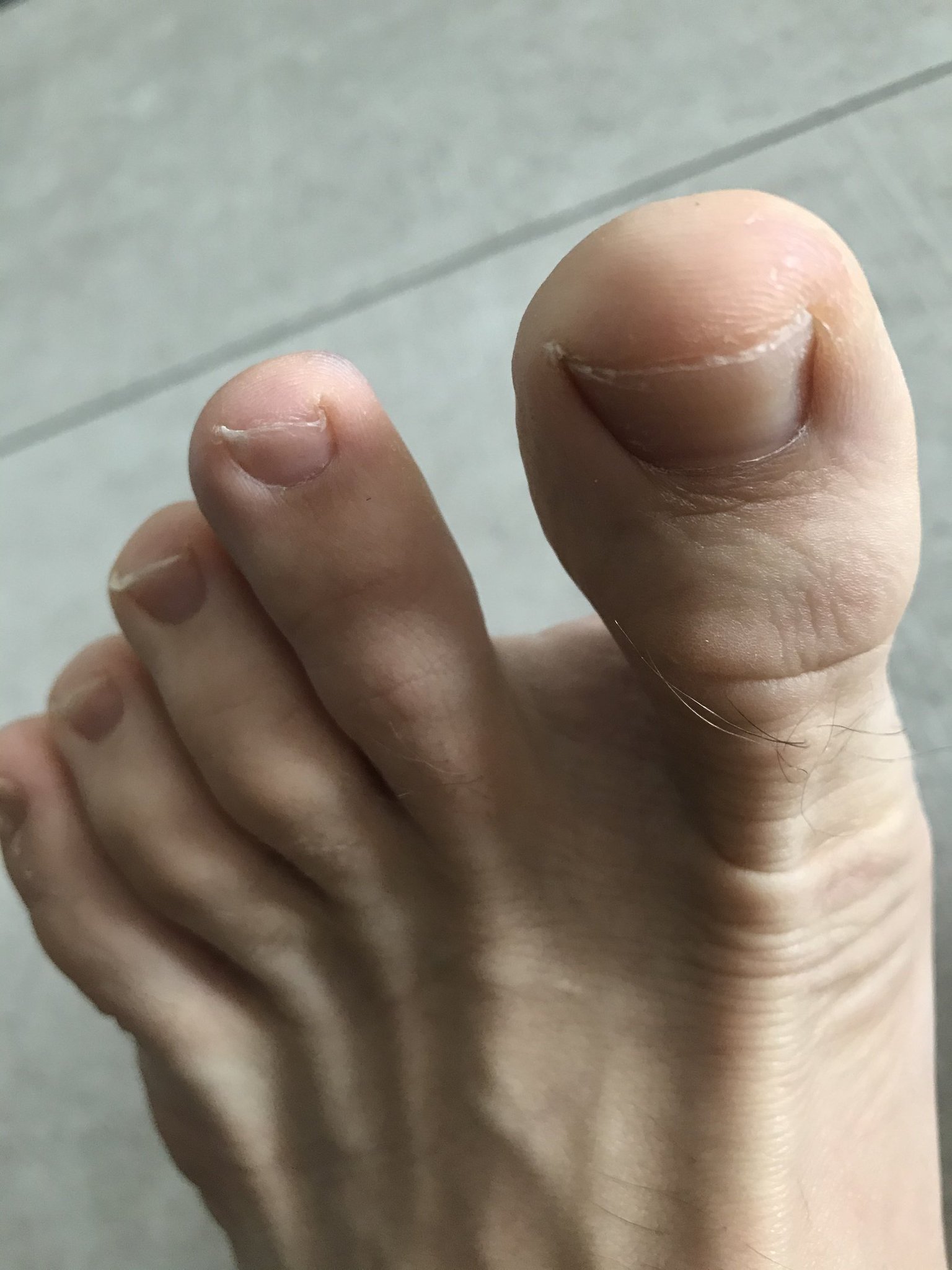 2 pic. Hey you miserable losers. Guess what time it is? Time to grovel at the feet of a superior alpha