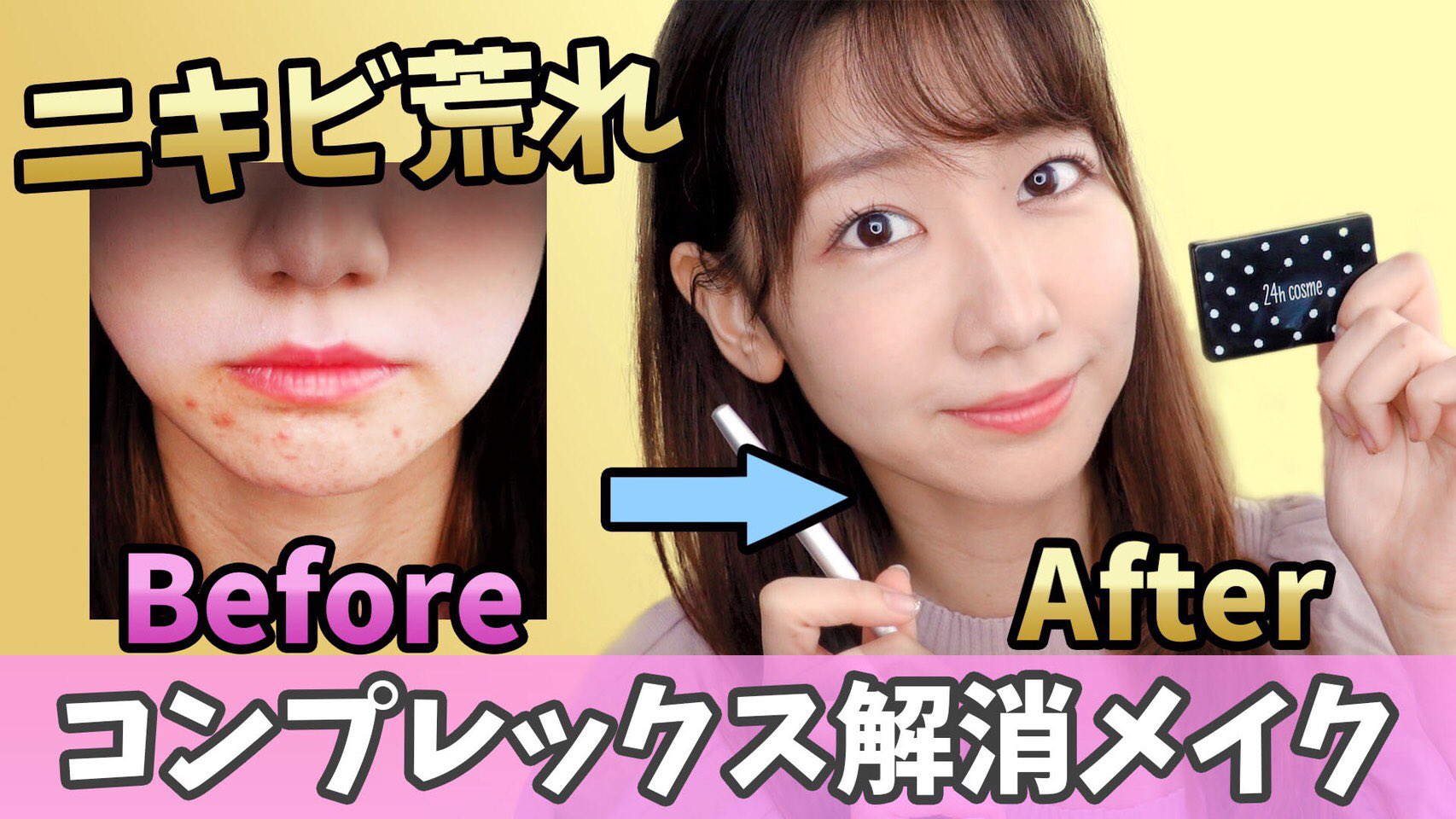 柏木由紀 Youtube更新 ニキビ ニキビ跡 肌荒れを隠す コンプレックス解消動画です 同じような悩みを持つ方とこのメイク方法を共有できれば との思いです 簡単ですのでぜひ観てみてください T Co Jgkc9fhxmu T Co Sna2neqyr7