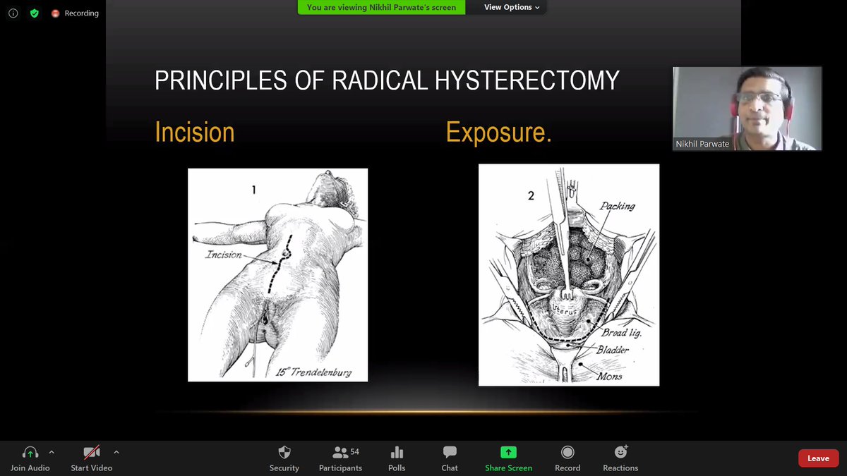 NICPR-ECHO tweet media