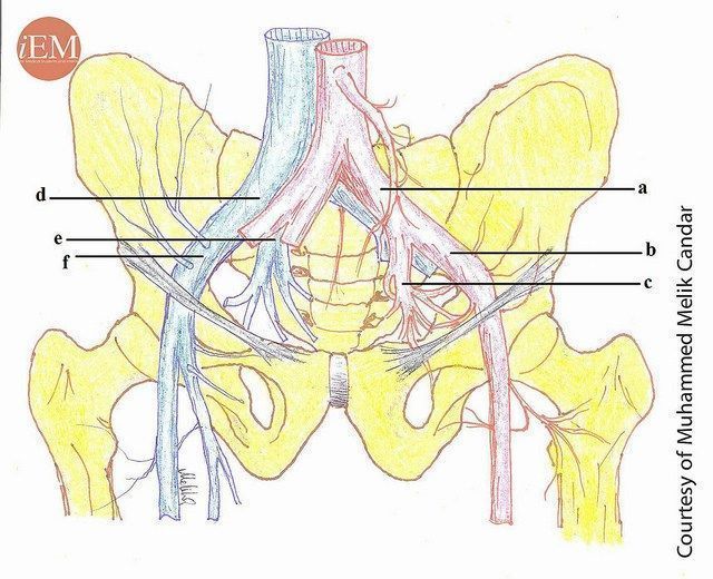 iem_student's tweet photo. "Pelvic Injuries" by Sercan Yalcinli
#FOAMed #emergencymedicine #ICON360 #iEMstudent #ED #MedEd #medicalstudent #clerkship #EmergencyDepartment #Fracture #Disclocation #orthopedics #Pain #Hip #Pelvis #surgery 

Read full text: https://t.co/wd8mxWxuYf https://t.co/MvDRLJIe5Z