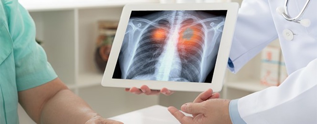 MESCO_UK's tweet photo. To coincide with World Lung Cancer Day, the Institution of Occupational Safety and Health (#IOSH) reminded employers to protect their staff from one of world’s biggest killers caused by exposure to carcinogens such as asbestos, silica dust and diesel fumes
https://t.co/iZ4Atj2msD https://t.co/qMp5CXZq18