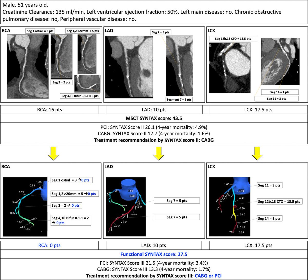 Currently, there are more than 10 noninvasive and invasive modalities to evaluate coronary physiology. This state-of-the-art review discusses the application of these modalities prior to arrival to the #CathLab, prior to #PCI, and post-PCI. bit.ly/2Dp9lz1 #JACCINT