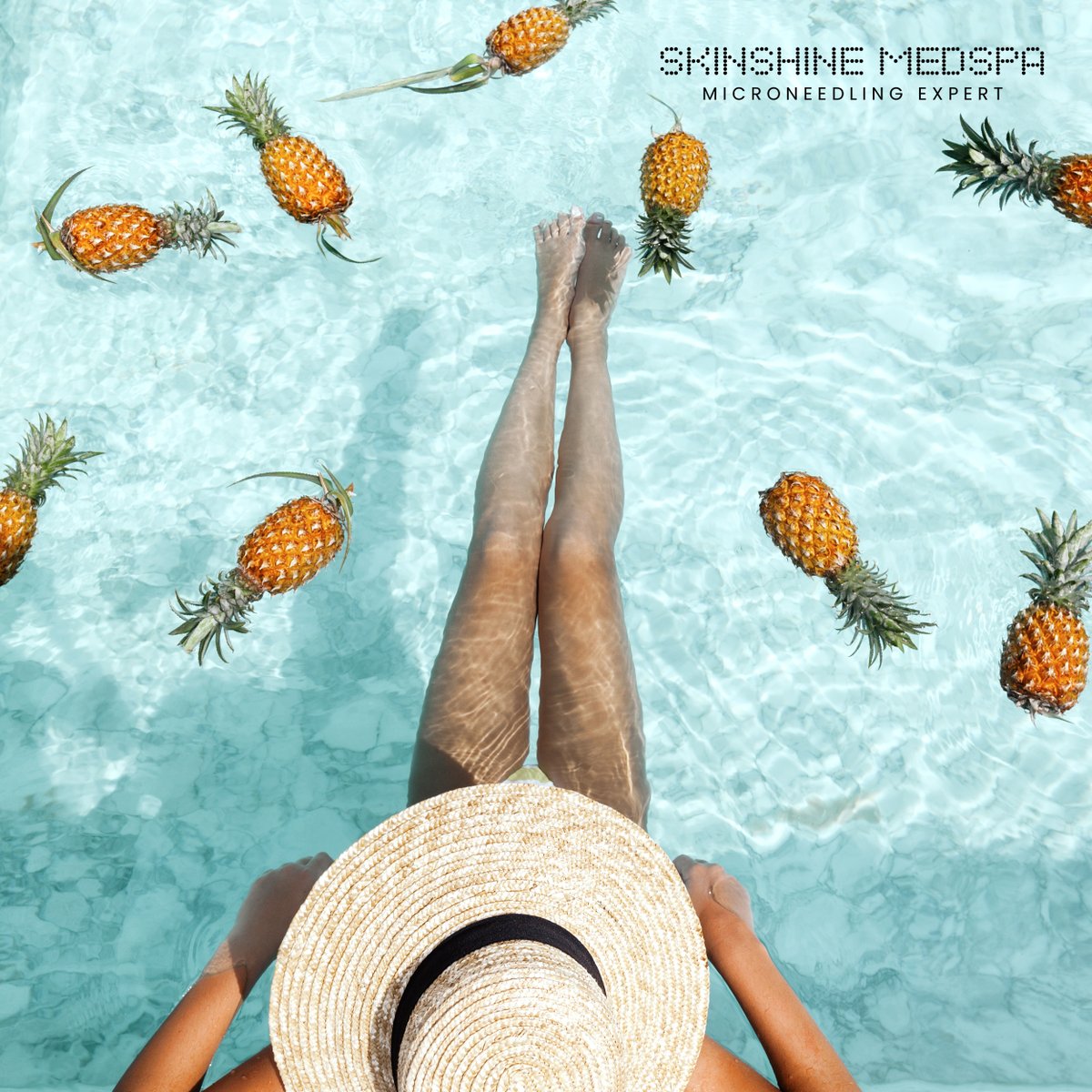 SkinShineMedSpa's tweet photo. Did you know pineapples act as sweet as they taste? Vitamins and antioxidants found in pineapples and their juices treat acne, have antiaging properties, prevent pimples, and treat dark spots! 
#skincare #beauty #skincareroutine #skin #skincareproducts #skincaretips #glowingskin https://t.co/fMH9tIr60Y