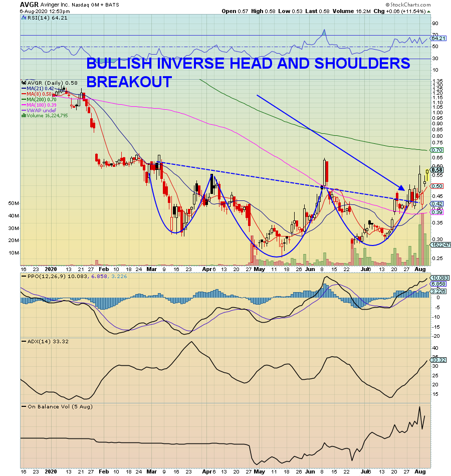 RadioSilentplay's tweet photo. $AVGR .58 Follow the charts 

LOOK at the room on the daily

2 week close above .56 balance of probability $3 

Charts will not lie https://t.co/lIqQwVRcCE