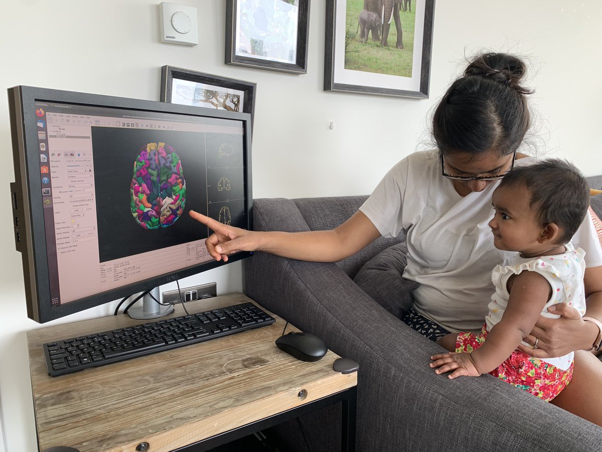 aswinchari's tweet photo. @DNP_ICH Hereβs me trying to better understand the MRI scans of children with epilepsy and explain what Iβm doing to my wife and daughter!
#In2Lockdown #epilepsy #neurosurgery @in2scienceUK https://t.co/yst6F6CSZc