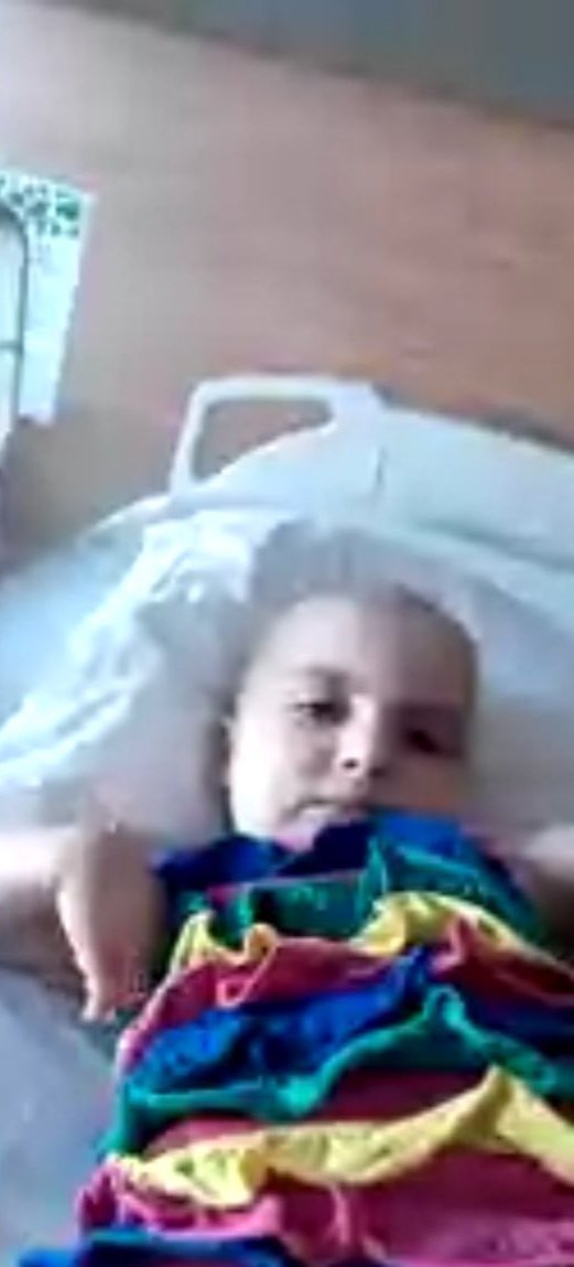 ÇOK ACİL‼️

Adana Acıbadem hastanesinde durumu ağır ❗

Minik yavrumuz Derinsu için çok acil
İlik nakli gerekiyor❗

3 tüp kan hayat kurtarır❗

Haydi #Adana
Derinsuya Umut Olalım ‼️

Acil RT destek canlar yayalım‼️‼️